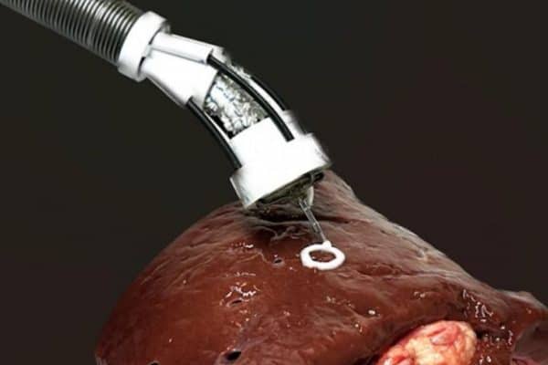 3d bioprinting inside