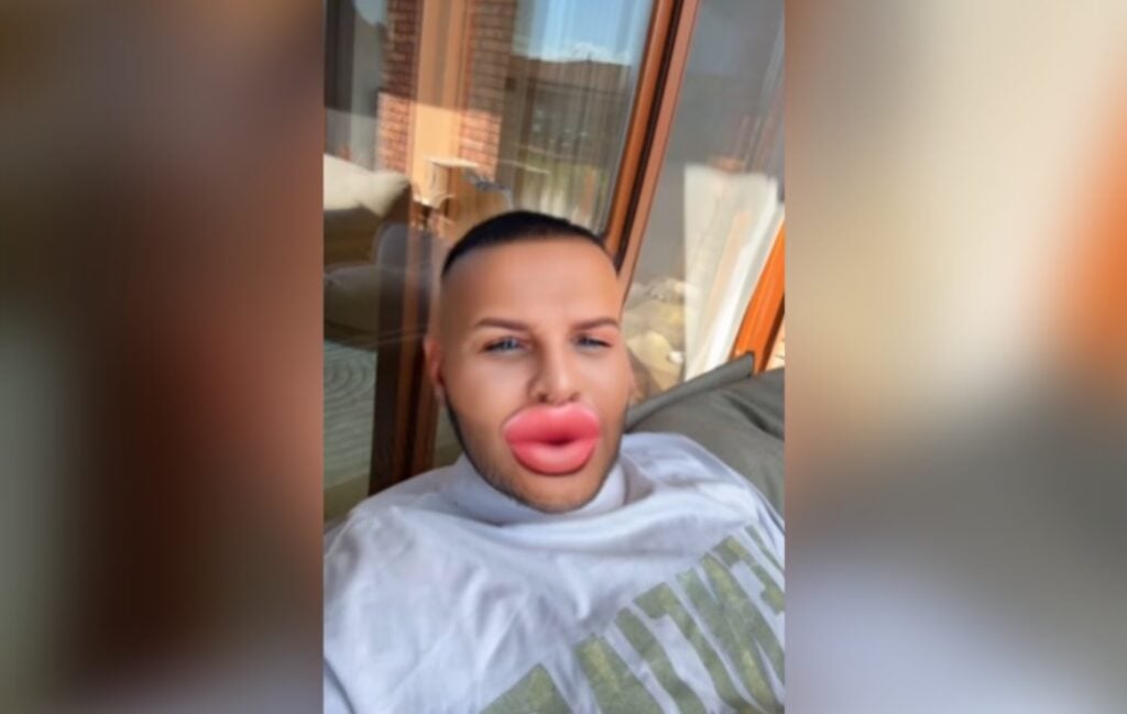 rytmus lgbt