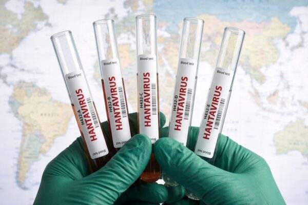 hantavirus